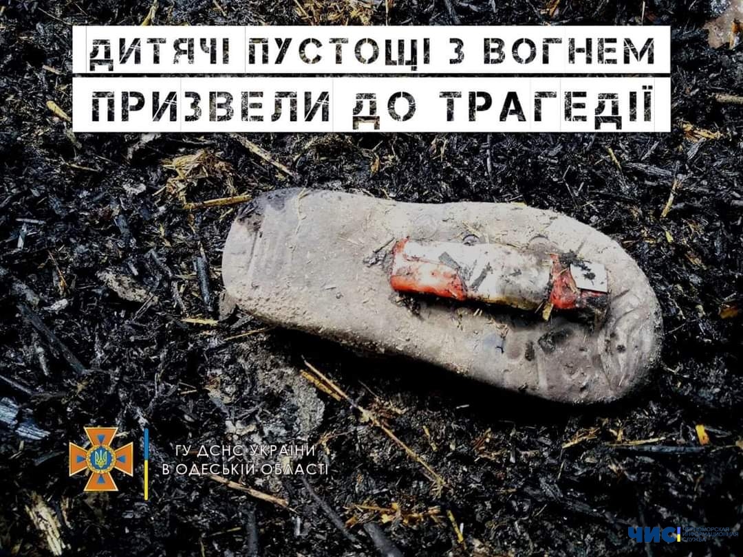У Білгород-Дністровському районі через пустощі з вогнем дитина отримала опіки 90% тіла
